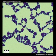 staphylococcus aureus under microscope
